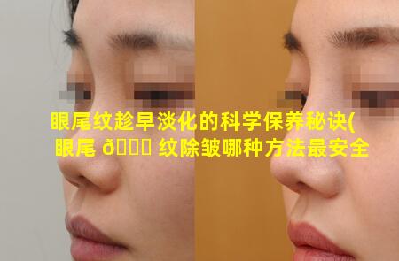 眼尾纹趁早淡化的科学保养秘诀(眼尾 🐈 纹除皱哪种方法最安全)